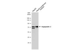Invitrogen Angiopoietin 2 Polyclonal Antibody 100 &mu;L | Buy Online | Invitrogen&trade; | Fisher Scientific