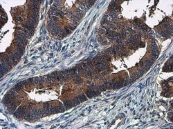 Invitrogen Amphiregulin Polyclonal Antibody 100 &mu;L; Unconjugated:Antibodies,