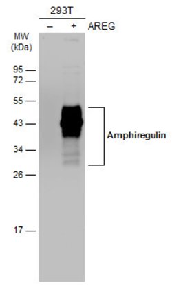 Invitrogen Amphiregulin Polyclonal Antibody 100 &mu;L; Unconjugated:Antibodies,