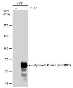Invitrogen PKLR Polyclonal Antibody 100 &mu;L | Buy Online | Invitrogen&trade; | Fisher Scientific