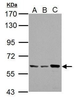Invitrogen PKLR Polyclonal Antibody 100 &mu;L | Buy Online | Invitrogen&trade; | Fisher Scientific