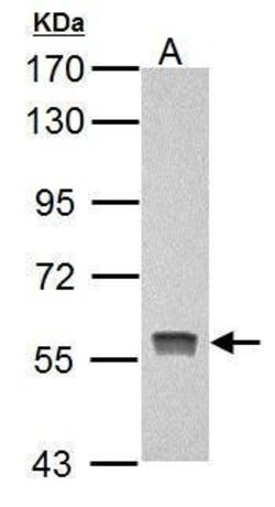 Invitrogen PKLR Polyclonal Antibody 100 &mu;L | Buy Online | Invitrogen&trade; | Fisher Scientific