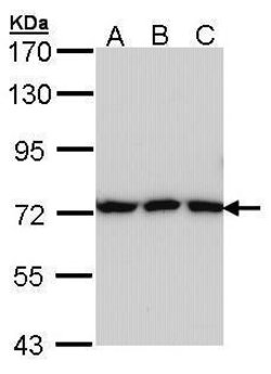 Invitrogen Transferrin Polyclonal Antibody 100 &mu;L; Unconjugated:Antibodies,