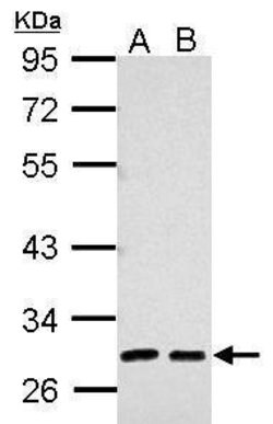 Invitrogen alpha-1 Microglobulin Polyclonal Antibody 100 &mu;L; Unconjugated:Antibodies,