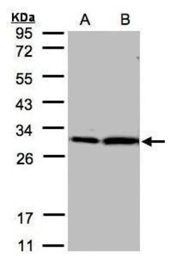 Invitrogen 14-3-3 zeta Polyclonal Antibody 100 &mu;L; Unconjugated:Antibodies,