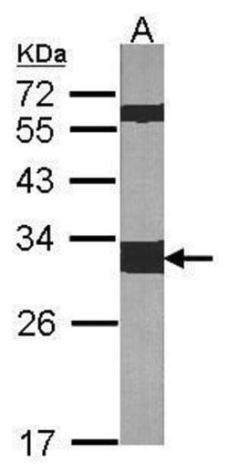 Invitrogen 14-3-3 zeta Polyclonal Antibody 100 &mu;L; Unconjugated:Antibodies,