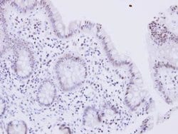 Invitrogen&trade;&nbsp;WRN Polyclonal Antibody