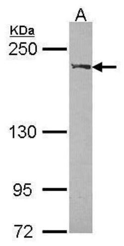 Invitrogen WRN Polyclonal Antibody 100 &mu;L | Buy Online | Invitrogen&trade; | Fisher Scientific