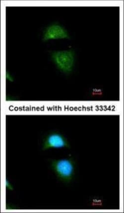 Invitrogen Cytochrome P450 Reductase Polyclonal Antibody 100 &mu;L; Unconjugated:Antibodies,