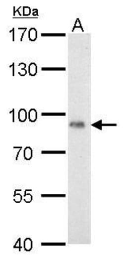 Invitrogen Cytochrome P450 Reductase Polyclonal Antibody 100 &mu;L; Unconjugated:Antibodies,