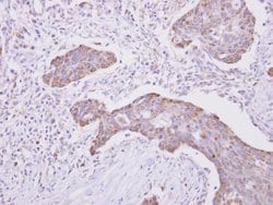 Invitrogen Cytochrome P450 Reductase Polyclonal Antibody 100 &mu;L; Unconjugated:Antibodies,