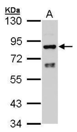 Invitrogen Cytochrome P450 Reductase Polyclonal Antibody 100 &mu;L; Unconjugated:Antibodies,