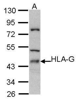 Invitrogen HLA-G Polyclonal Antibody 100 &mu;L; Unconjugated:Antibodies,