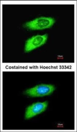 Invitrogen MIF Polyclonal Antibody 100 &mu;L | Buy Online | Invitrogen&trade; | Fisher Scientific
