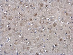 Invitrogen MIF Polyclonal Antibody 100 &mu;L | Buy Online | Invitrogen&trade; | Fisher Scientific