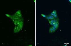 Invitrogen LIPA Polyclonal Antibody 100 &mu;L; Unconjugated:Antibodies,