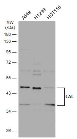 Invitrogen LIPA Polyclonal Antibody 100 &mu;L; Unconjugated:Antibodies,