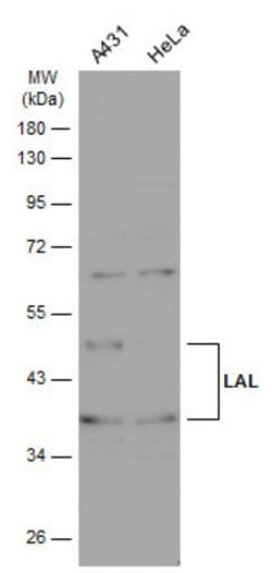 Invitrogen LIPA Polyclonal Antibody 100 &mu;L; Unconjugated:Antibodies,