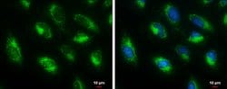 Invitrogen HADHA Polyclonal Antibody 100 &mu;L; Unconjugated:Antibodies,