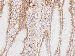 Invitrogen HADHA Polyclonal Antibody 100 &mu;L; Unconjugated:Antibodies,