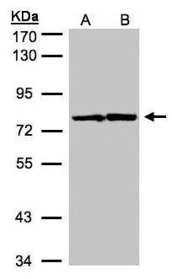 Invitrogen HADHA Polyclonal Antibody 100 &mu;L; Unconjugated:Antibodies,