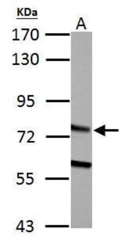 Invitrogen HADHA Polyclonal Antibody 100 &mu;L; Unconjugated:Antibodies,
