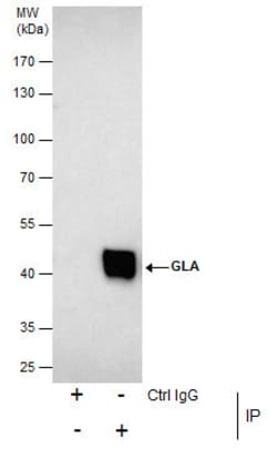 Invitrogen alpha Galactosidase Polyclonal Antibody 100 &mu;L; Unconjugated:Antibodies,