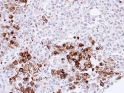 Invitrogen Gelsolin Polyclonal Antibody 100 &mu;L | Buy Online | Invitrogen&trade; | Fisher Scientific