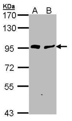 Invitrogen Gelsolin Polyclonal Antibody 100 &mu;L | Buy Online | Invitrogen&trade; | Fisher Scientific