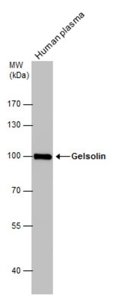 Invitrogen Gelsolin Polyclonal Antibody 100 &mu;L | Buy Online | Invitrogen&trade; | Fisher Scientific