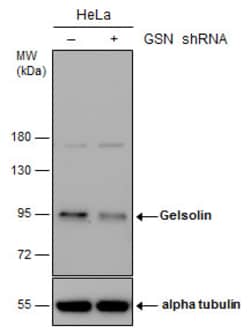 Invitrogen Gelsolin Polyclonal Antibody 100 &mu;L | Buy Online | Invitrogen&trade; | Fisher Scientific