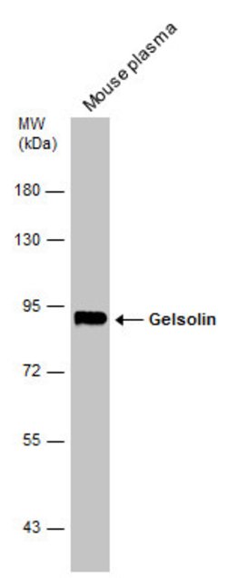 Invitrogen Gelsolin Polyclonal Antibody 100 &mu;L | Buy Online | Invitrogen&trade; | Fisher Scientific