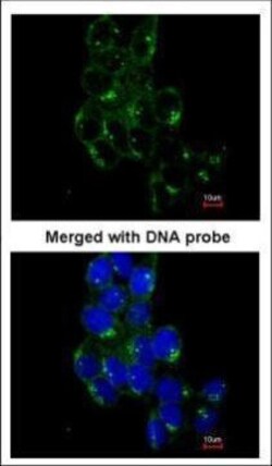 Invitrogen Fyn Polyclonal Antibody 100 &mu;L; Unconjugated:Antibodies,