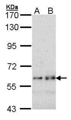 Invitrogen Fyn Polyclonal Antibody 100 &mu;L; Unconjugated:Antibodies,