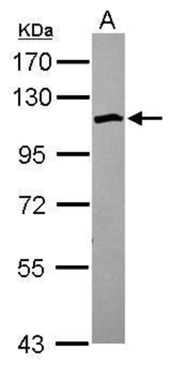 Invitrogen SCP1 Polyclonal Antibody 100 &mu;L | Buy Online | Invitrogen&trade; | Fisher Scientific