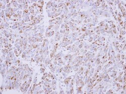 Invitrogen G6PD Polyclonal Antibody 100 &mu;L; Unconjugated:Antibodies,
