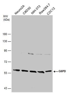 Invitrogen G6PD Polyclonal Antibody 100 &mu;L; Unconjugated:Antibodies,