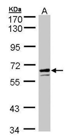 Invitrogen G6PD Polyclonal Antibody 100 &mu;L; Unconjugated:Antibodies,