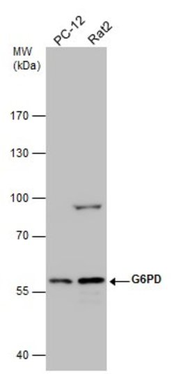 Invitrogen G6PD Polyclonal Antibody 100 &mu;L; Unconjugated:Antibodies,