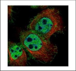 Invitrogen Lyn Polyclonal Antibody 100 &mu;L; Unconjugated:Antibodies,