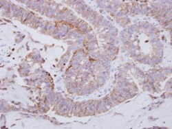 Invitrogen Lyn Polyclonal Antibody 100 &mu;L; Unconjugated:Antibodies,