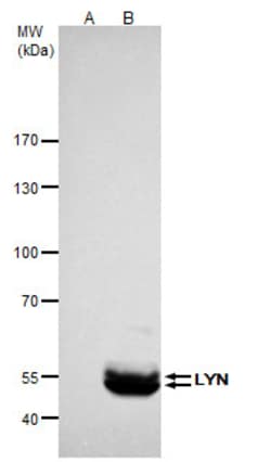 Invitrogen Lyn Polyclonal Antibody 100 &mu;L; Unconjugated:Antibodies,