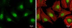 Invitrogen E2F1 Polyclonal Antibody 100 &mu;L; Unconjugated:Antibodies,