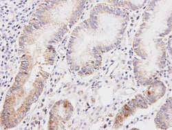 Invitrogen DLD Polyclonal Antibody 100 &mu;L; Unconjugated:Antibodies,