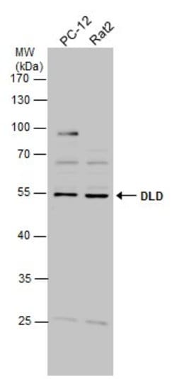 Invitrogen DLD Polyclonal Antibody 100 &mu;L; Unconjugated:Antibodies,