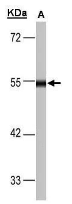 Invitrogen DLD Polyclonal Antibody 100 &mu;L; Unconjugated:Antibodies,