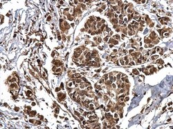 Invitrogen CBP Polyclonal Antibody 100 &mu;L; Unconjugated:Antibodies,