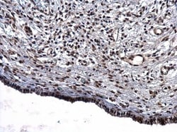 Invitrogen CBP Polyclonal Antibody 100 &mu;L; Unconjugated:Antibodies,
