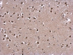 Invitrogen CBP Polyclonal Antibody 100 &mu;L; Unconjugated:Antibodies,