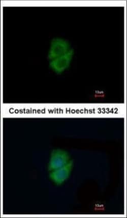 Invitrogen Decorin Polyclonal Antibody 100 &mu;L | Buy Online | Invitrogen&trade; | Fisher Scientific